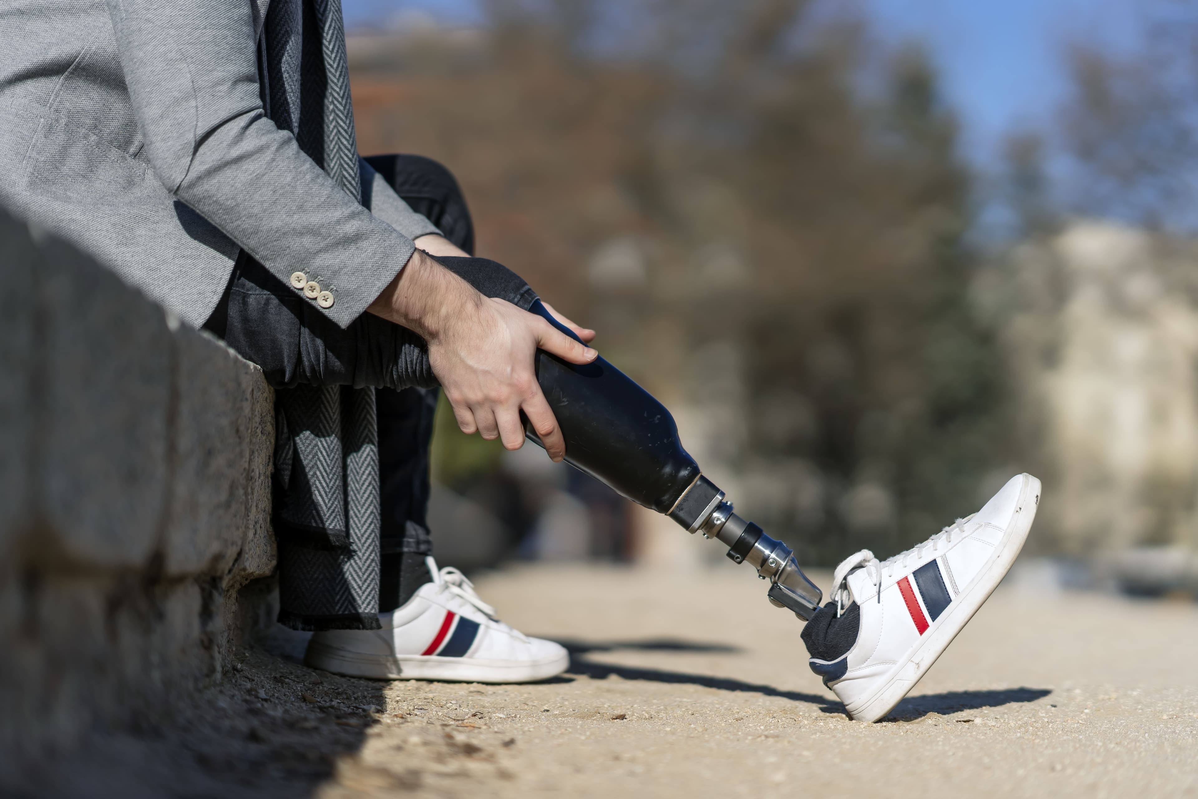Limb Prosthetics